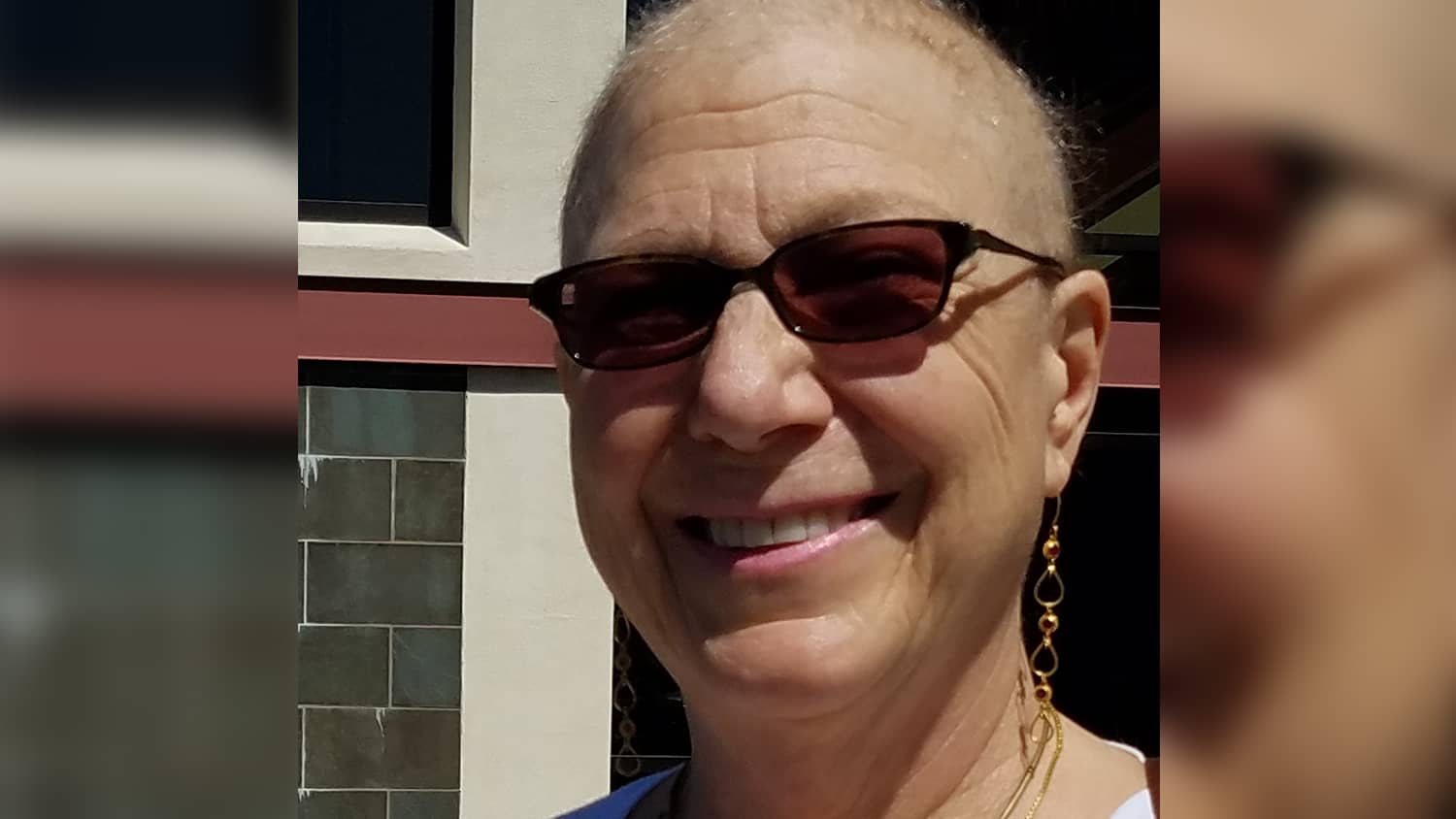 Bald, Bold, Brave and Beautiful – What Losing My Hair Meant During My  Cancer Treatment | Sixty and Me